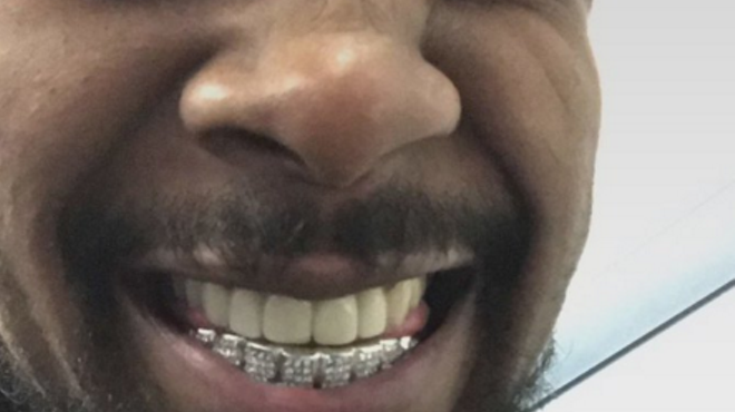 Smile, Danny Brown fixed his iconic teeth