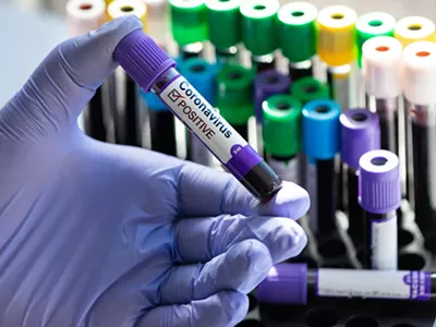 Image: Michigan artificially inflated its coronavirus testing numbers