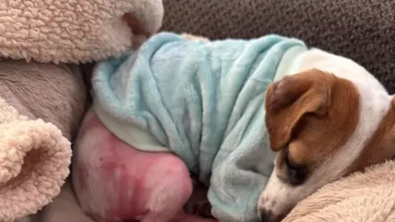 Gideon was recovering from severe burn to several parts of his body.