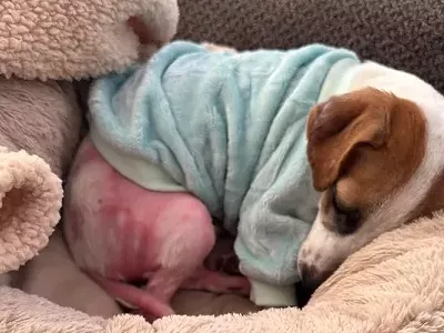 Gideon was recovering from severe burn to several parts of his body.