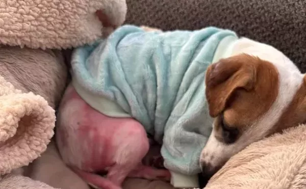 Gideon was recovering from severe burn to several parts of his body.