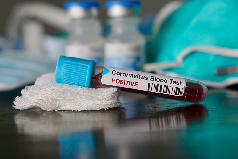 Michigan at risk of running out of coronavirus test kits after 2 positive cases